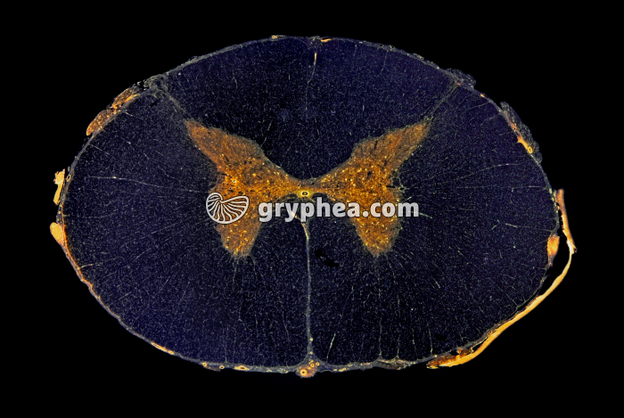 Moelle épinière humaine CT x1 - gryphea.org